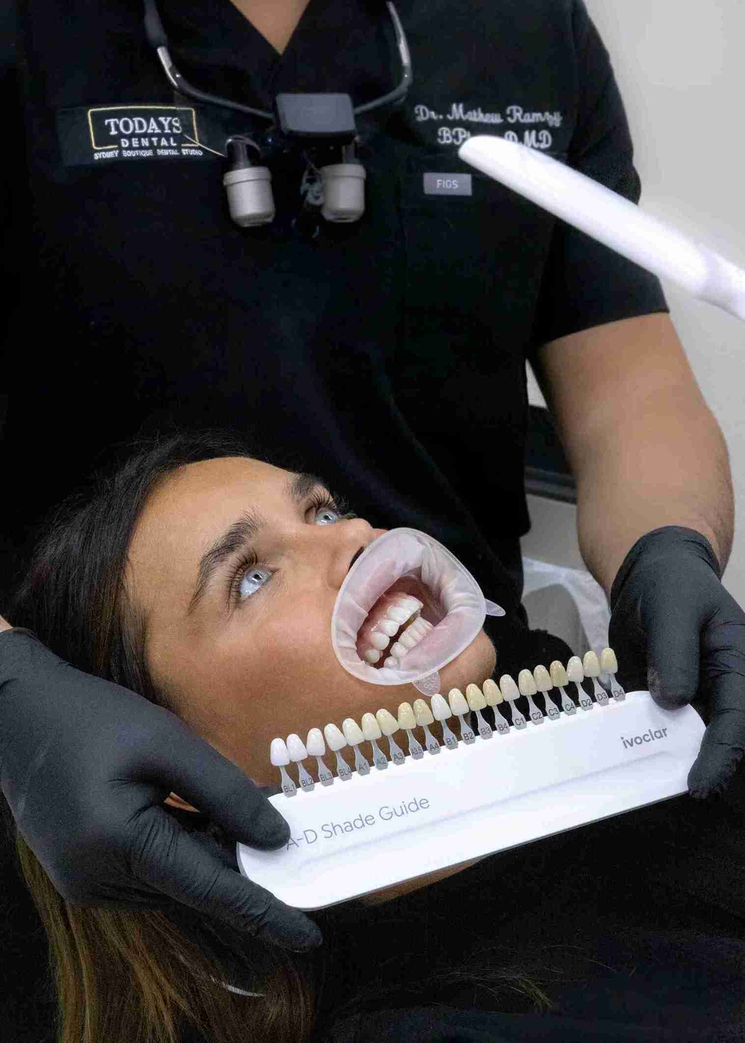 Composite-Resin-Veneers-scaled.webp