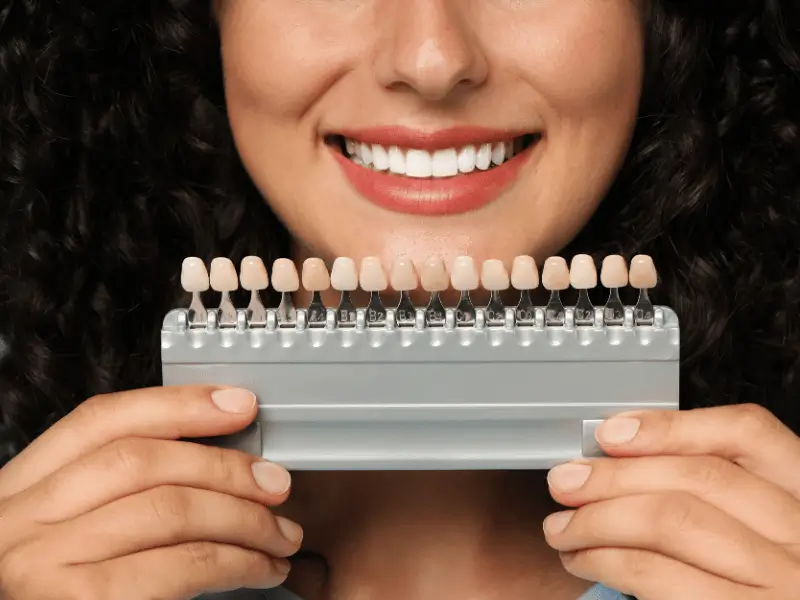 Porcelain vs Composite Veneers