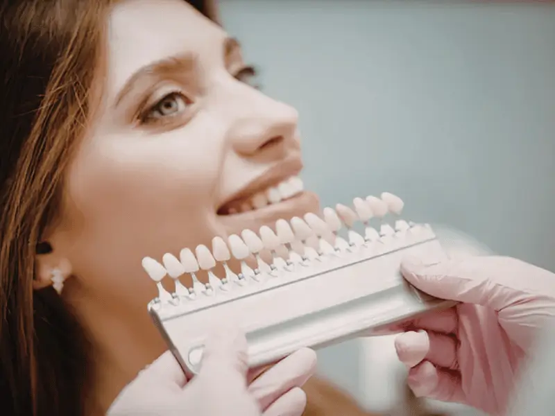 Dental Veneers