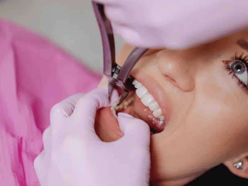 Root Canal vs Tooth Extraction