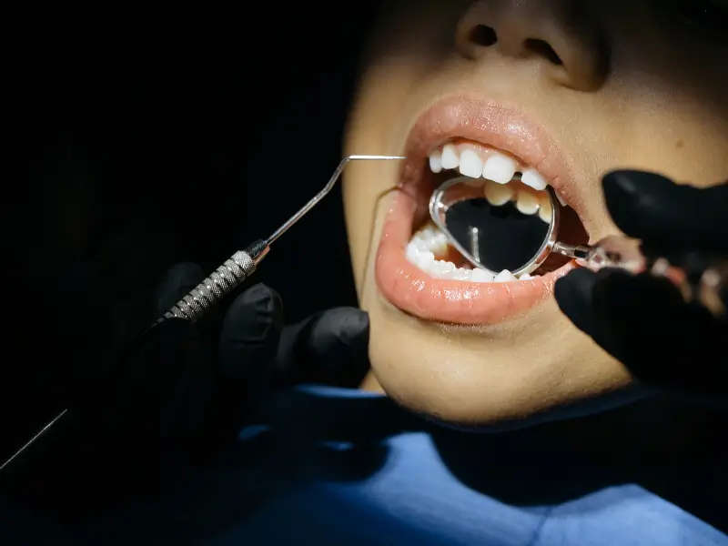 Dental Implant
